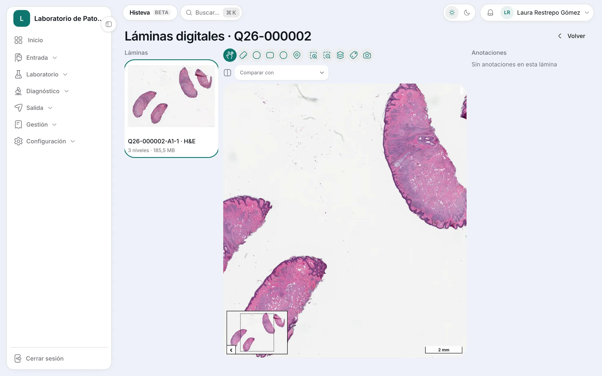 Visor de láminas digitales de Histeva con un corte H&E