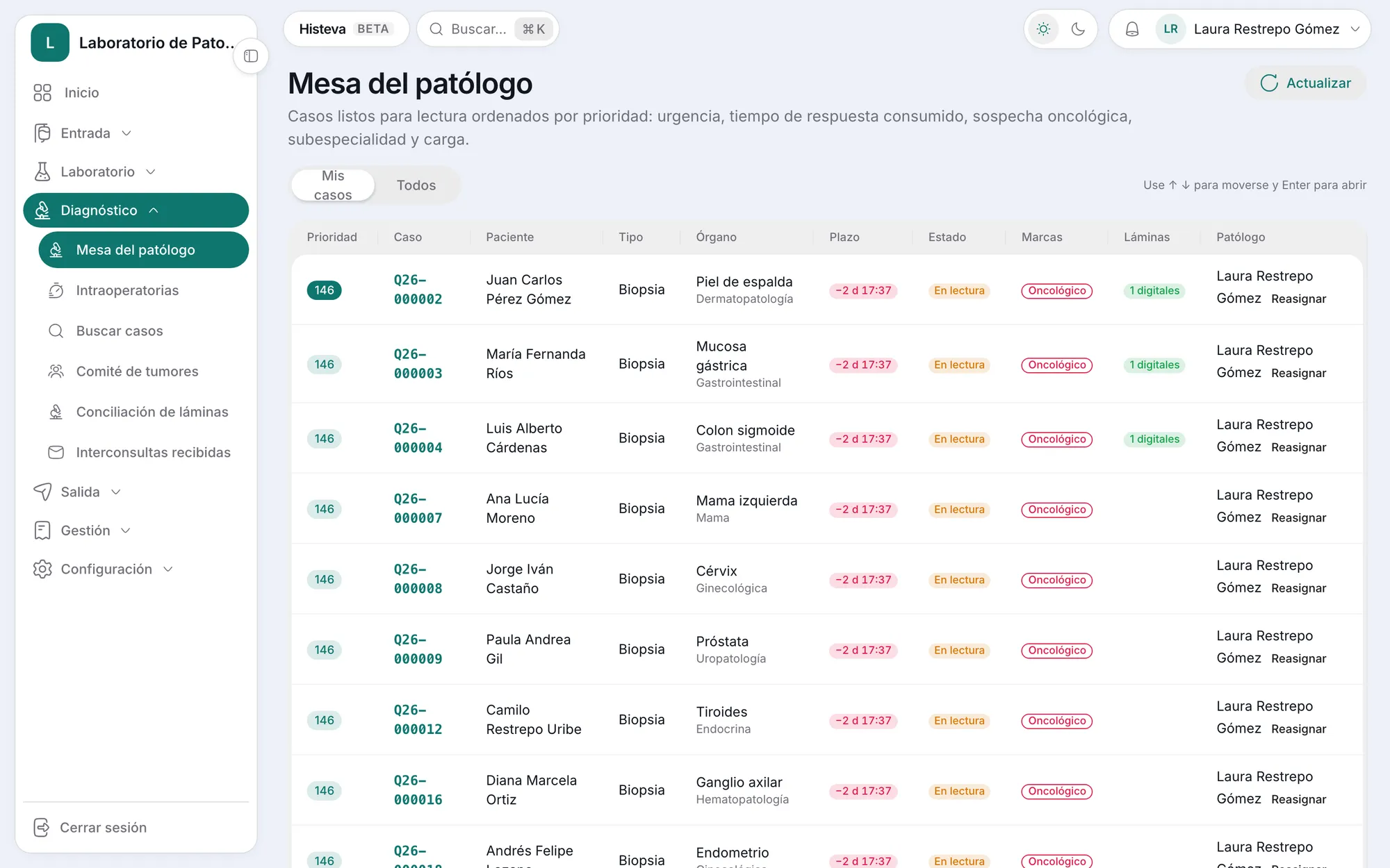 Mesa del patólogo en Histeva